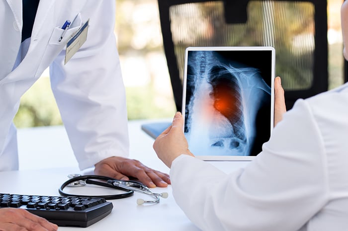 Lung scan-1387879944