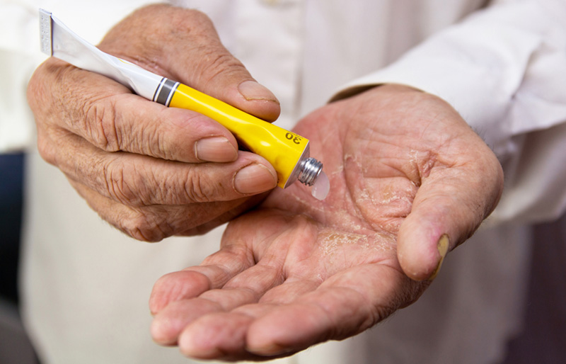 Topicals & Non-Pharmacologic Options